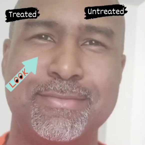 NEW! Rapid Rewind Wrinkle Reducer - Picture 9 of 16